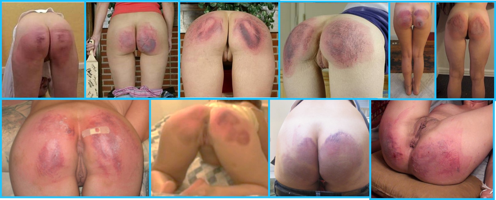 1613px x 653px - Severe Bruised Bottom Spanking | BDSM Fetish