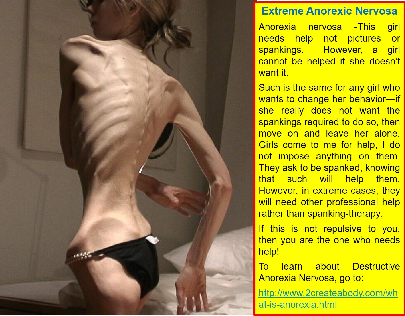 Is zendaya anorexic